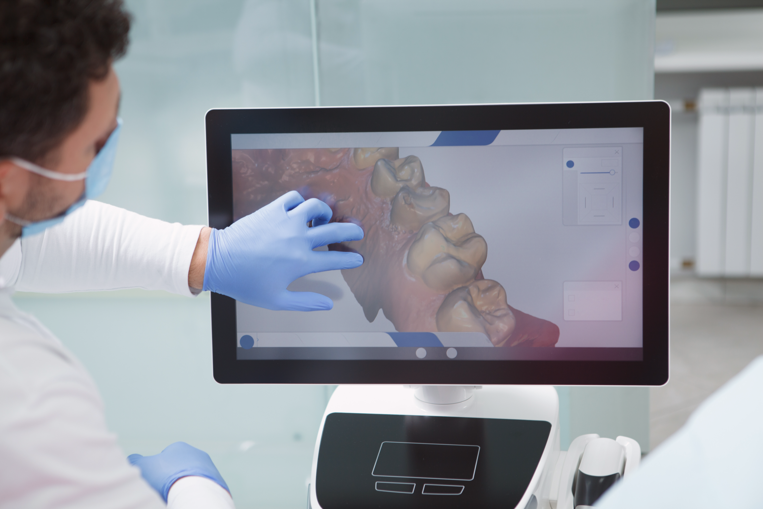 3D Intraoral Scan