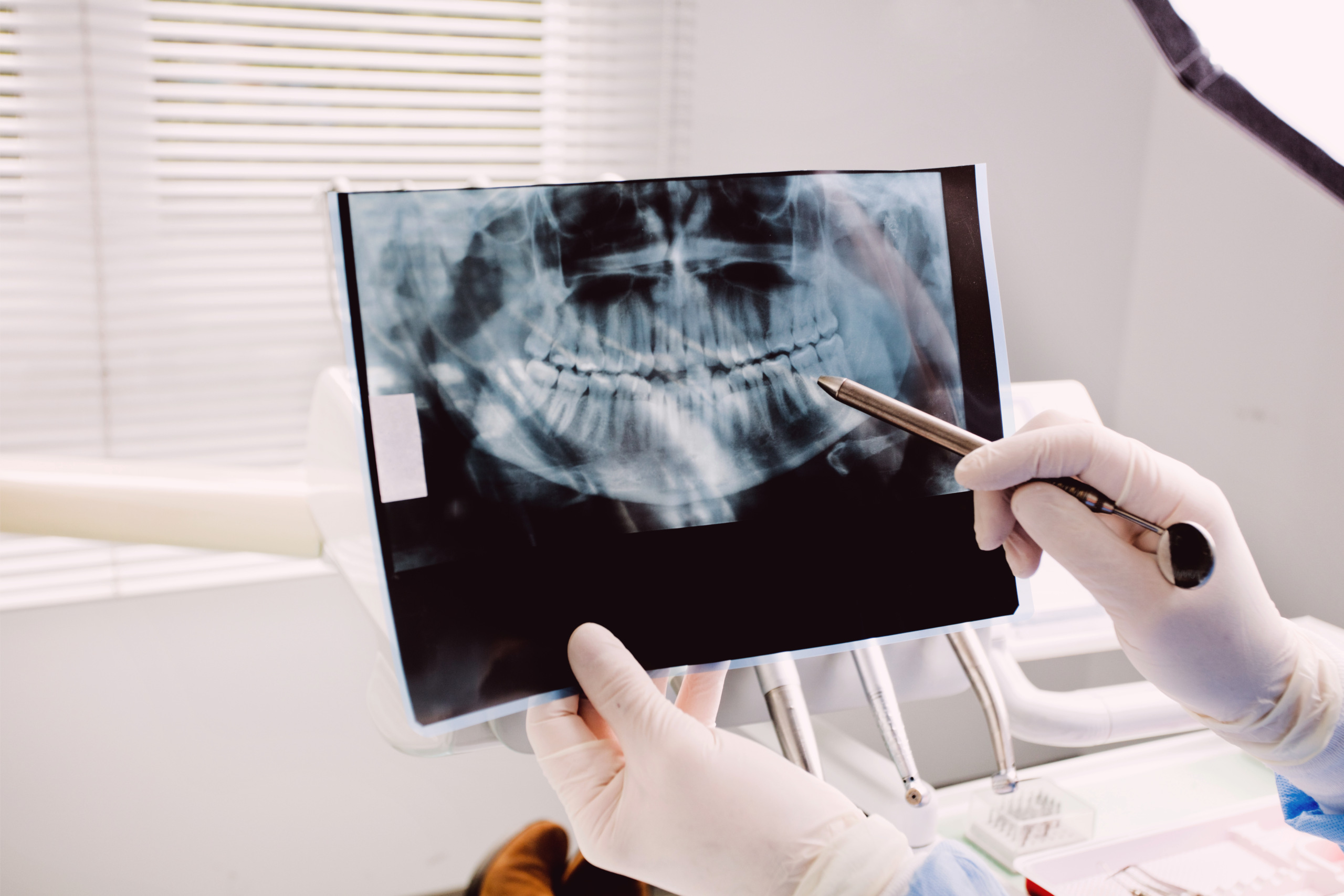 Smile Monitoring at Gwinnett Orthodontics