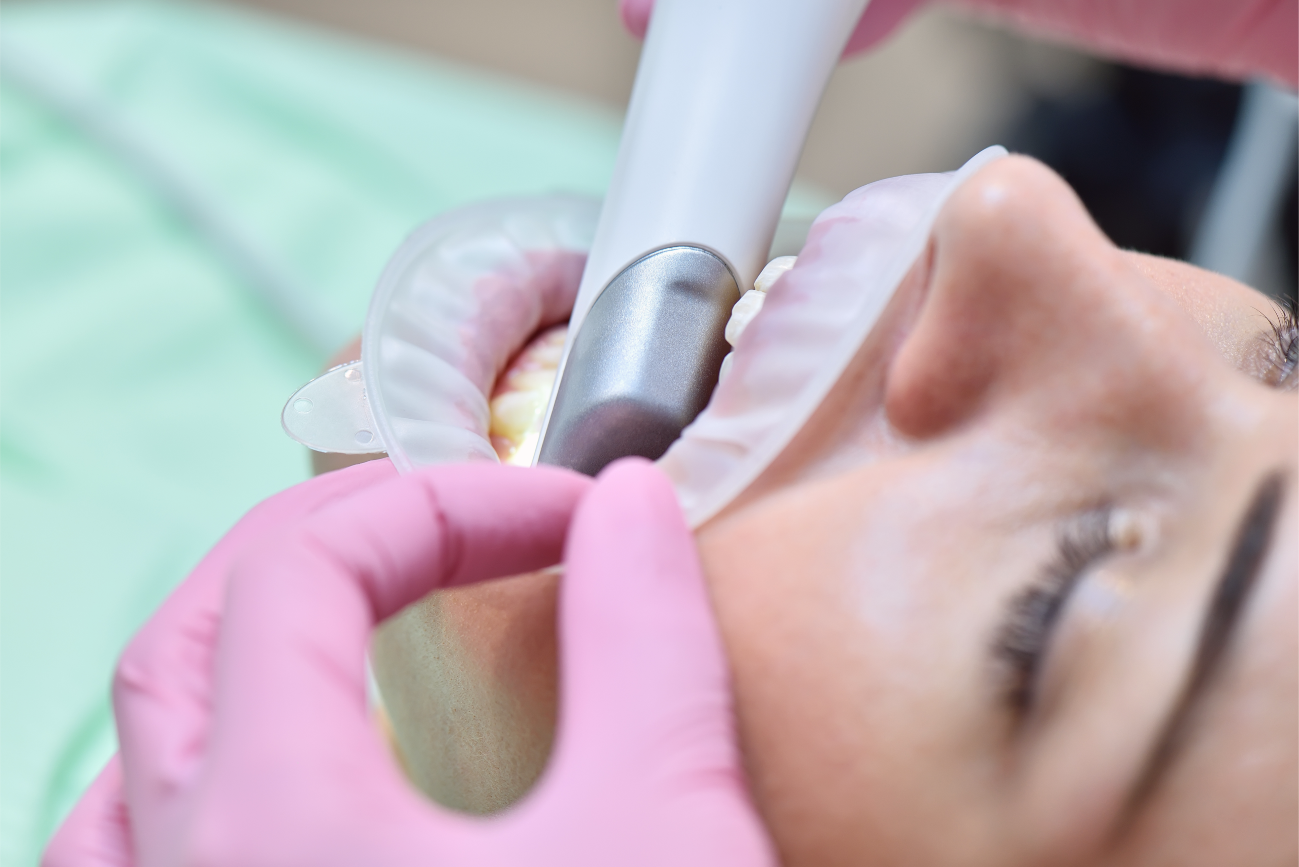 3D Dental Scan